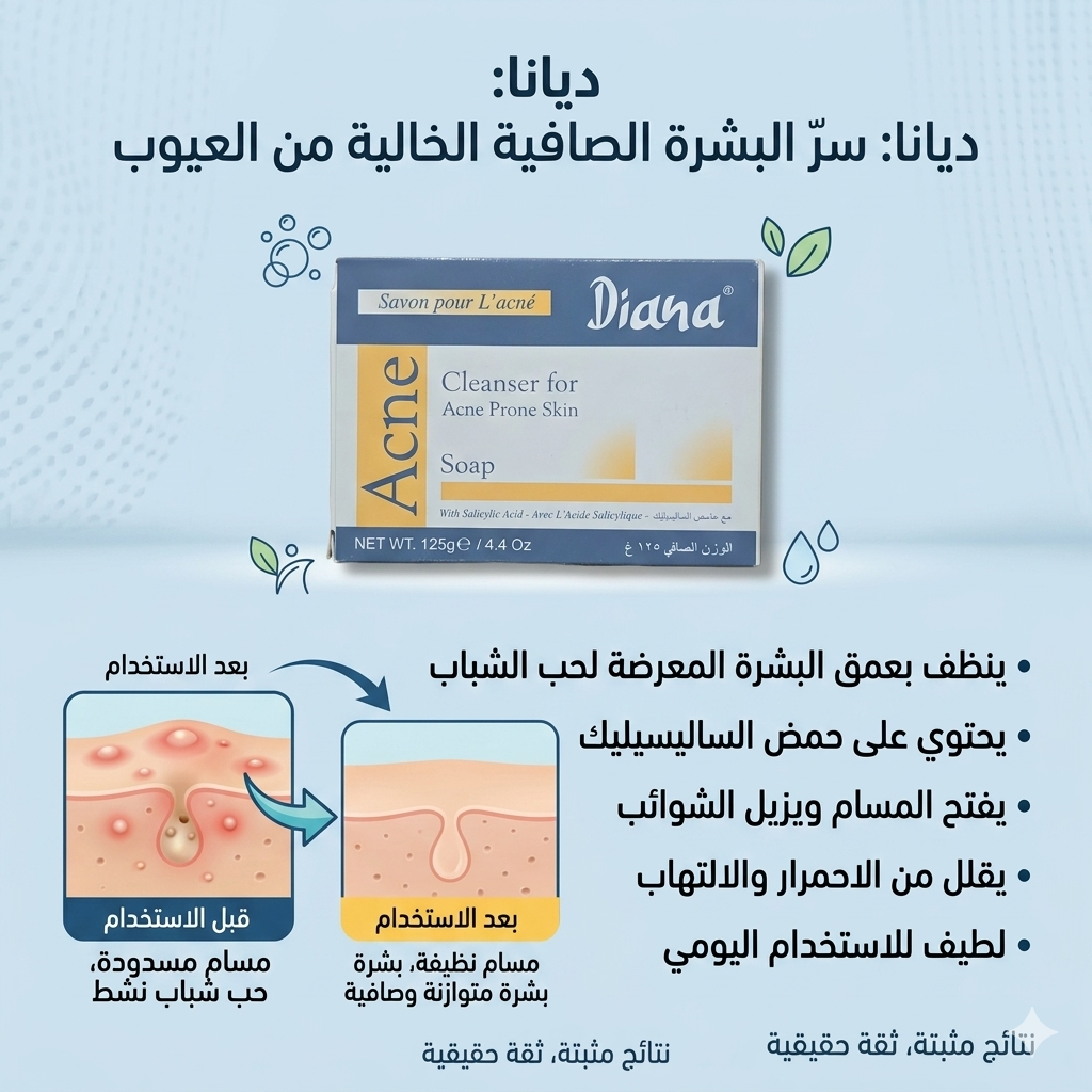 صابون ديانا لحب الشباب (Diana Acne Soap)